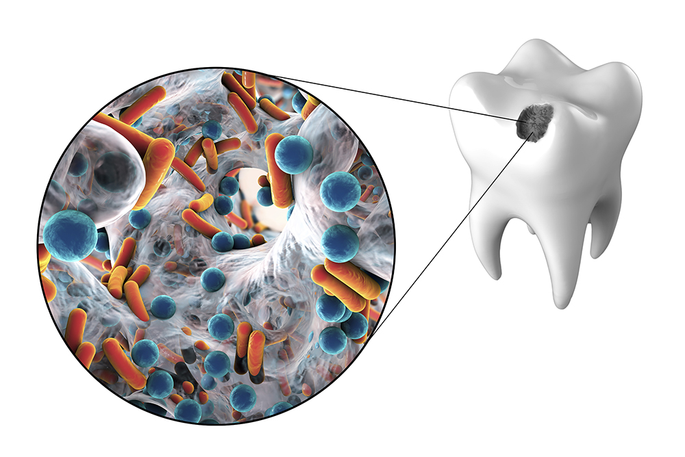 Conservativa - Studio dentistico associato Cerri