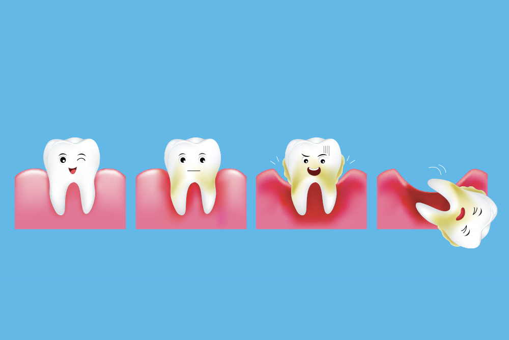 Igiene e prevenzione - Studio dentistico associato Cerri