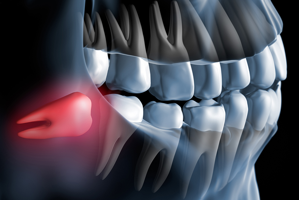 Chirurigia - Studio dentistico associato Cerri