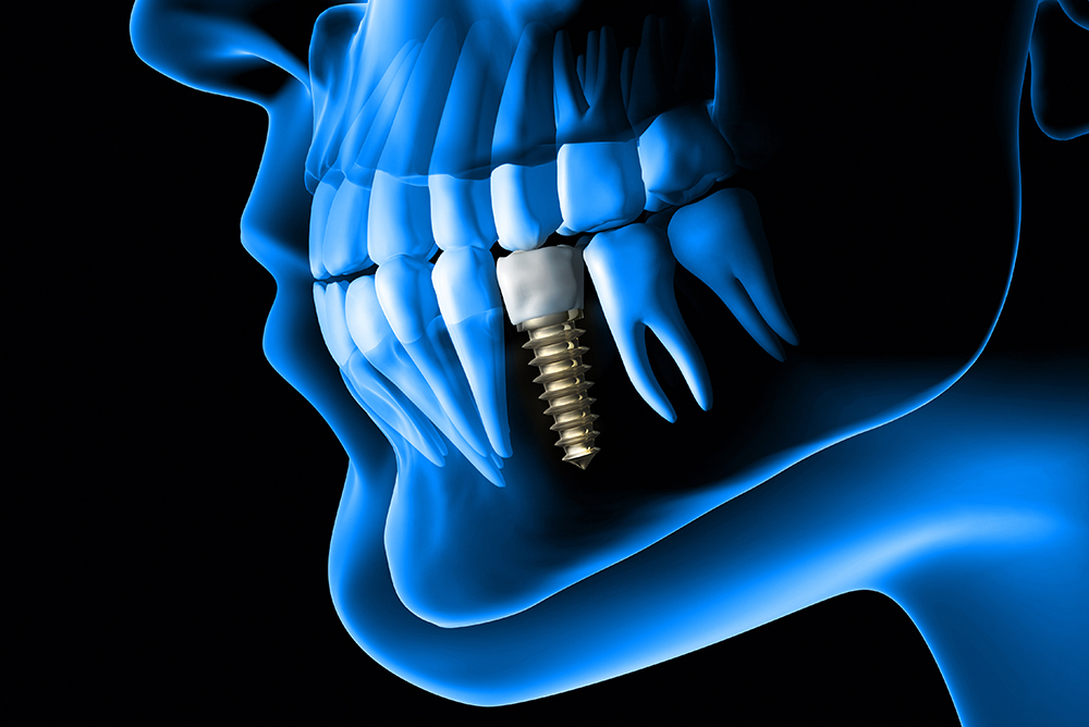 Chirurigia - Studio dentistico associato Cerri