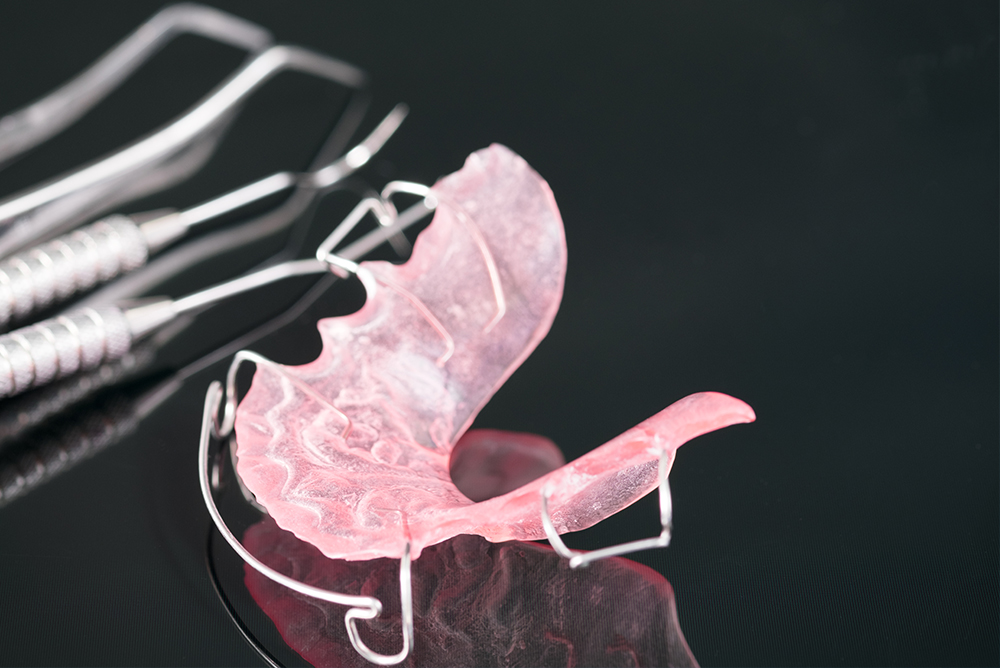 Ortodonzia - Studio dentistico associato Cerri