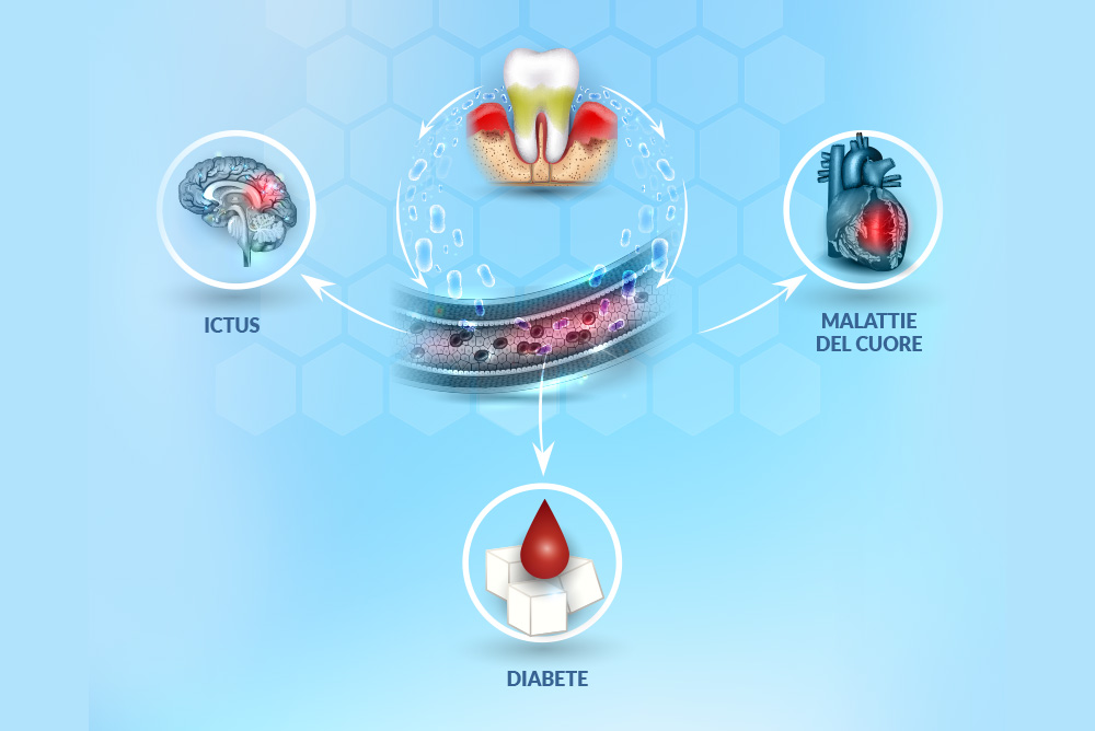 Igiene e prevenzione - Studio dentistico associato Cerri
